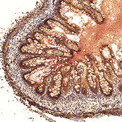 sars-cov-2 gene expression in a human fetus